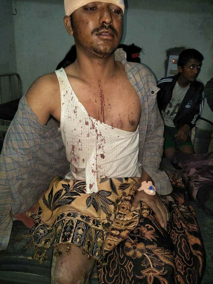 दुई/दुई पटक छतबाट हाम फालेर ज्यान बचाए यी पत्रकारले