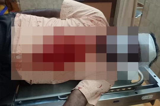 विरोध प्रदर्शनका क्रममा पत्रकारमाथिको आक्रमण बढ्दोः यूनेस्को